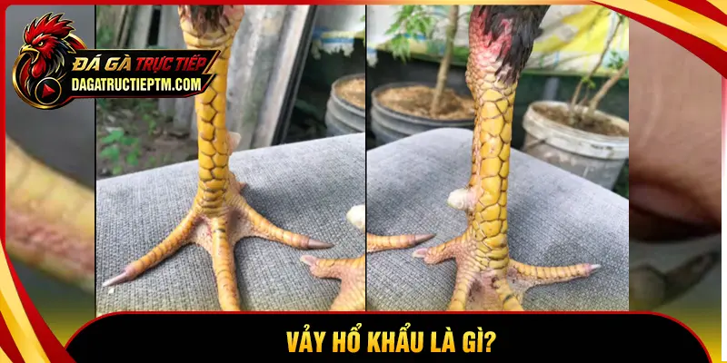 Vảy Hổ Khẩu là gì?
