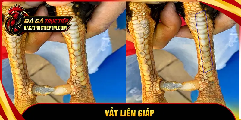 Vảy Liên Giáp - Khám phá giáp nội, ngoại tốt hay xấu?